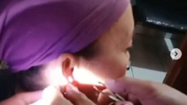 Penutup Anting Tersangkut di Kulit, Wanita Ini Minta Tolong Damkar