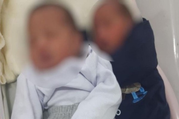 Wanita di Brasil Lahirkan Bayi Kembar dari 2 Ayah yang Berbeda