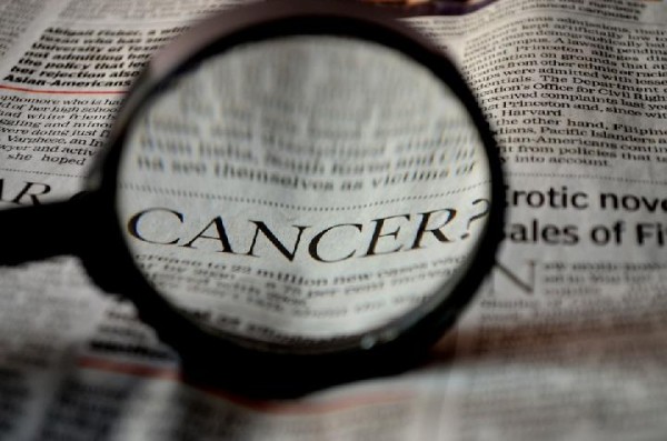 Rhabdomyosarcoma Jenis Kanker Langka Yang Terbentuk Di Jaringan Lunak