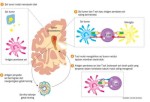 Spesialis neuroonkologi Viola Maharani: Sakit Kepala Berat, Awas Gejala Tumor Otak