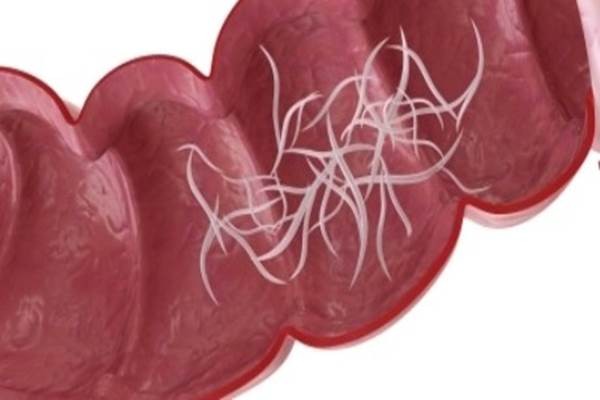 Cacingan Bisa Menular Dari Ibu Ke Anak, Lakukan Pencegahan Sebelum Terjadi Penularan!