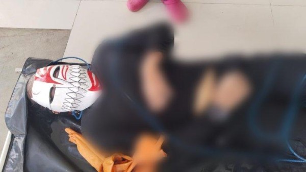 Polisi Masih Menyelidiki Misteri Jenazah Bertopeng di Bali, Ditemukan Luka Pada Kepala