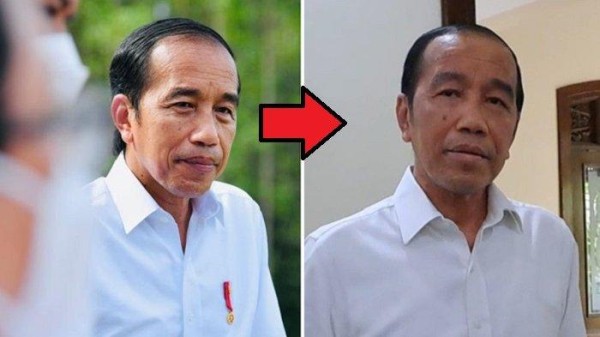 Apakah Penyakit Jokowi Berbahaya? Wajah Tampak Bengkak dan Ruam hingga Kulit Leher