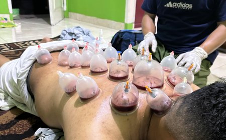 Bekam, Terapi Tradisional Bernilai Medis yang Kian Diminati