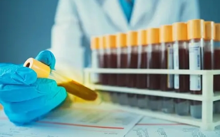 Ternyata “Darah Emas” Itu Ada! Golongan Darah Paling Langka di Dunia