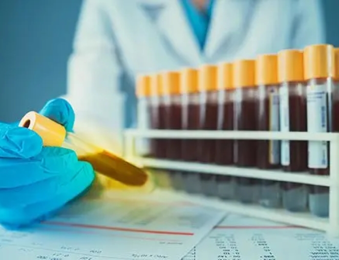 Ternyata “Darah Emas” Itu Ada! Golongan Darah Paling Langka di Dunia