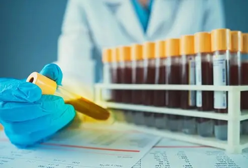 Ternyata “Darah Emas” Itu Ada! Golongan Darah Paling Langka di Dunia