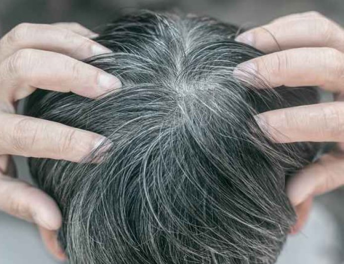 Jangan Minder Jika Usia Masih Muda tapi Sudah Ubanan