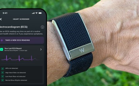 Whoop Band: Gelang Pintar untuk Memantau Kesehatan dan Performa Tubuh
