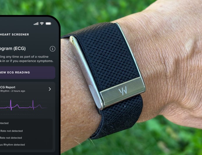 Whoop Band: Gelang Pintar untuk Memantau Kesehatan dan Performa Tubuh