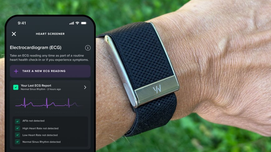 Whoop Band: Gelang Pintar untuk Memantau Kesehatan dan Performa Tubuh