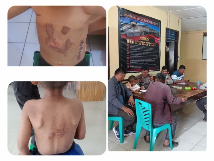 Sadis, Ibu Asal Seribudolok Simalungun Ini Tega Seterika Tubuh Bocah 6 Tahun Sadis, Ibu Asal Seribudolok Simalungun Ini Tega Seterika Tubuh Bocah 6 Tahun