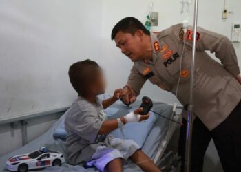 Bermain Mobil Remote Bersama Kapolres Simalungun, Bocah Korban Disetrika Tante Terlihat Ceria