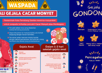 Ini Keterangan Kadis Kesehatan Menyikapi Maraknya Penyakit Gondongan di Kota Pematang Siantar