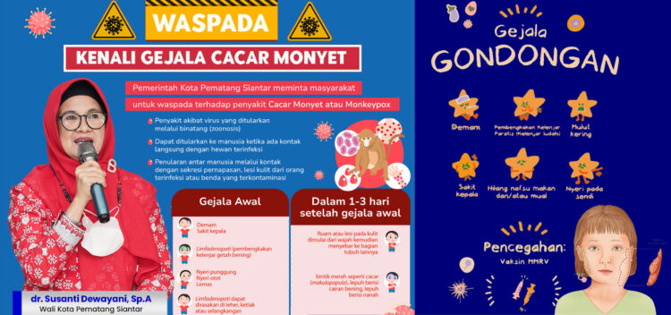Ini Keterangan Kadis Kesehatan Menyikapi Maraknya Penyakit Gondongan di Kota Pematang Siantar