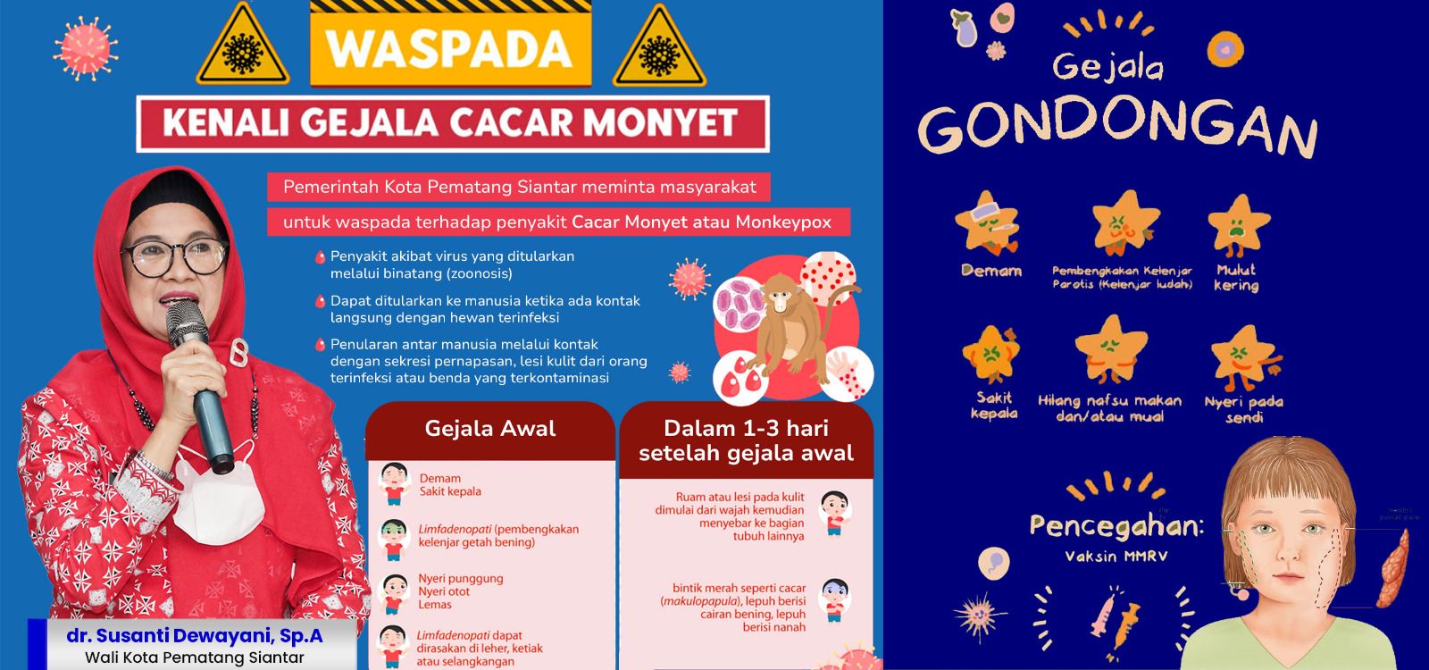 Ini Keterangan Kadis Kesehatan Menyikapi Maraknya Penyakit Gondongan di Kota Pematang Siantar