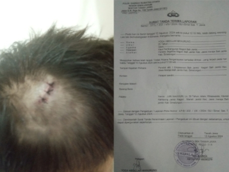 Kepala Yoga Manurung di hitting dan STPL pelapor ke Polsek Tanah Jawa