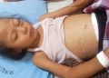 Seorang anak berusia lima tahun, Nursaidah, warga Kecamatan Pematang Bandar, Kabupaten Simalungun, yang menderita leukemia membutuhkan bantuan untuk menjalani pengobatan, di tengah kondisi ekonomi keluarga yang terbatas.