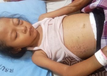 Seorang anak berusia lima tahun, Nursaidah, warga Kecamatan Pematang Bandar, Kabupaten Simalungun, yang menderita leukemia membutuhkan bantuan untuk menjalani pengobatan, di tengah kondisi ekonomi keluarga yang terbatas.