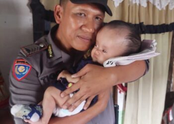 Sinergi Komunitas Padang Mainu Salurkan Bantuan Dukungan Buat Deni Aisyah Penderita Hidrosefalus