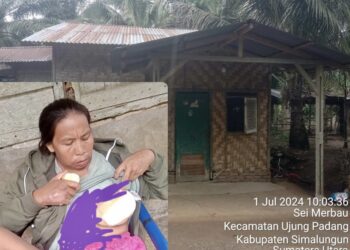Miris!! Mujiati Satu Tahun Melawan Kanker Payudara Tanpa Berobat, Pasrah Karena Ekonomi Lemah