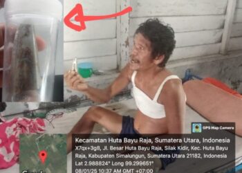 Ditemukan Besi Dalam Tubuh Pasien, Korban Tabrak Lari Diduga Malah Korban Malpraktek RSU Balimbingan, Aktivis Bersuara Itu Bisa Dilaporkan