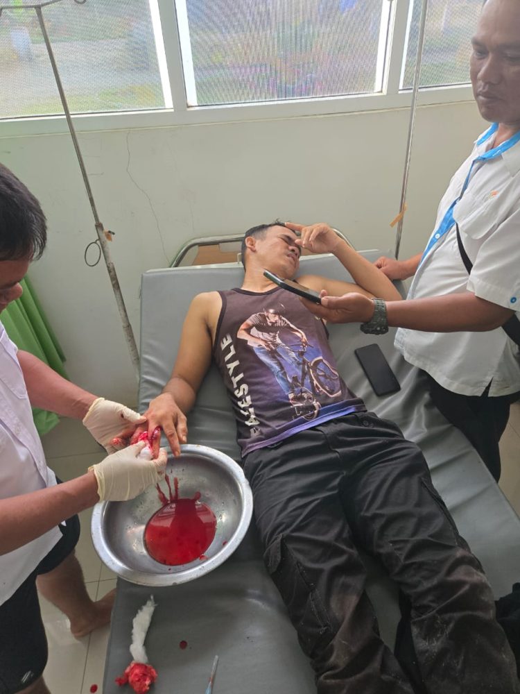 Crisnawan, seorang petugas keamanan dari PT Jaya Wira Manggala (PT JWM), terpaksa dirawat setelah dibacok dan dikeroyok terduga pelaku.