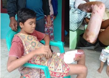 Menguak Insiden di SDN 097329 Sinta Dame,Difradik: “Sakit kali lebih baik aku mati”,Kepsek Lepas Tanggung Jawab Ayah Cari Keadilan