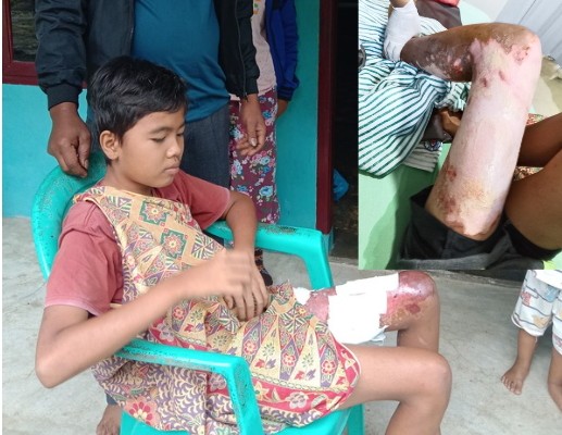 Kondisi korban saat ditemui di kediamannya, setiap pergerakan adalah derita bagi Difradik, Jumat (28/11/2025)