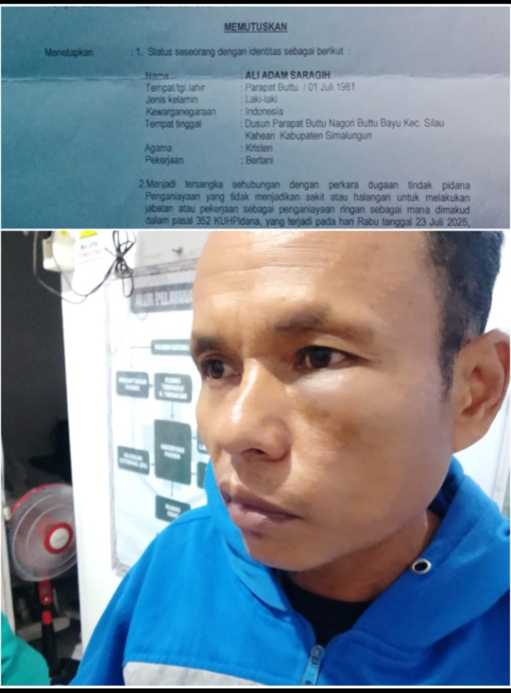 Surat penetapan tersangka (atas) dan korban penganiayaan, Ali Adam Saragih.