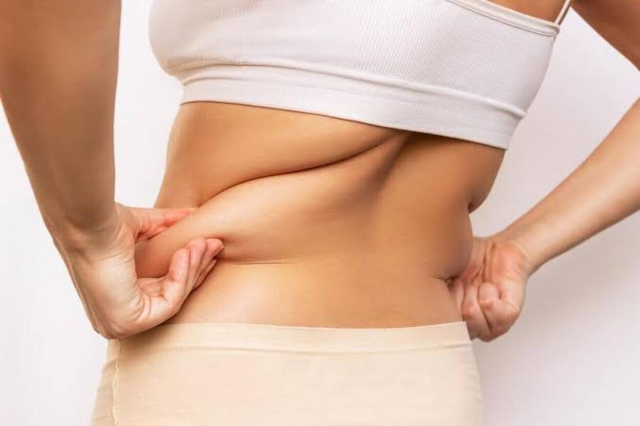 Mau Tubuh Bebas dari Lemak? Gak Pelu Diet Esktrim, Cukup Lakuin Ini