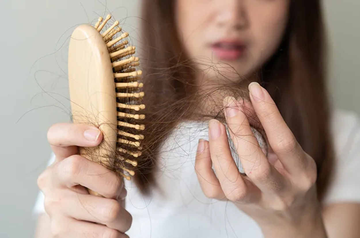 Ngerasa Rambut Sering Banget Rontok? Waspada Gen, Cari Tahu Penyebabnya