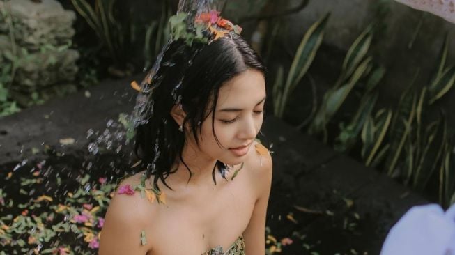 Aurelie Moeremans Alami Gegar Otak Parah Setelah Kecelakaan, Hasil MRI Bikin Nangis!