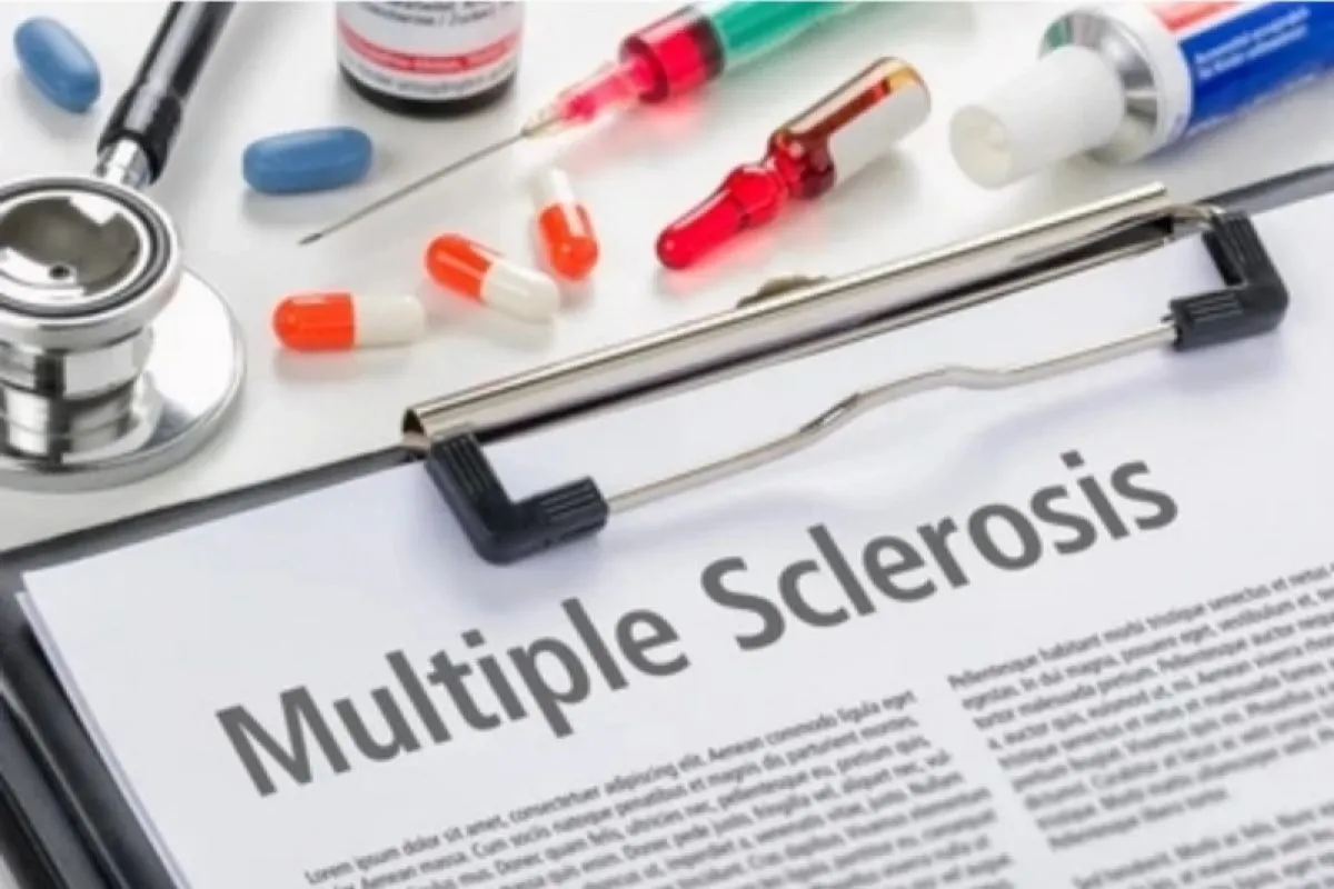 Waspada Multiple Sclerosis, Kenali Gejala Awal untuk Penanganan Cepat