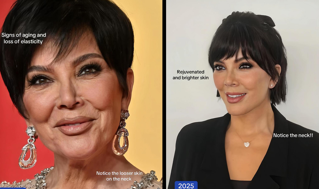 Kris Jenner Makin Muda di Usia Hampir 70 Tahun! Diduga Oplas Lagi dan Hasilnya Mirip Kylie?