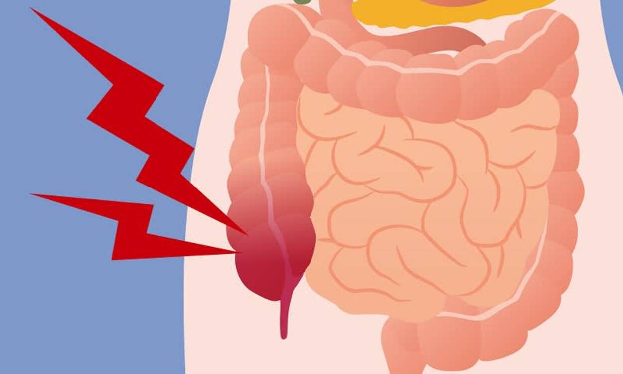 10 Kebiasaan Sepele yang Diam-Diam Bisa Bikin Masalah Pada Usus