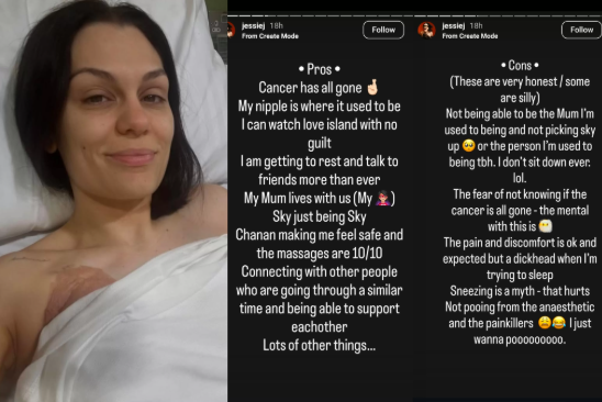 Jessie J Operasi Kanker Payudara Stadium Awal, Ini Kondisinya Sekarang!