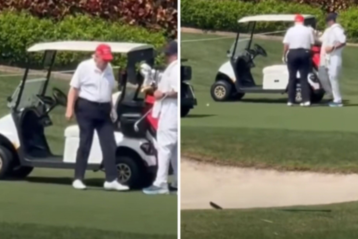 Kaki Trump Bengkak! Diduga Alami Gangguan Aliran Darah, Kondisi Apakah Ini?