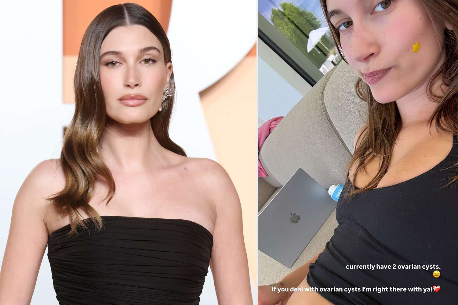 Baru Melahirkan, Hailey Bieber Ungkap Punya Dua Kista di Ovarium
