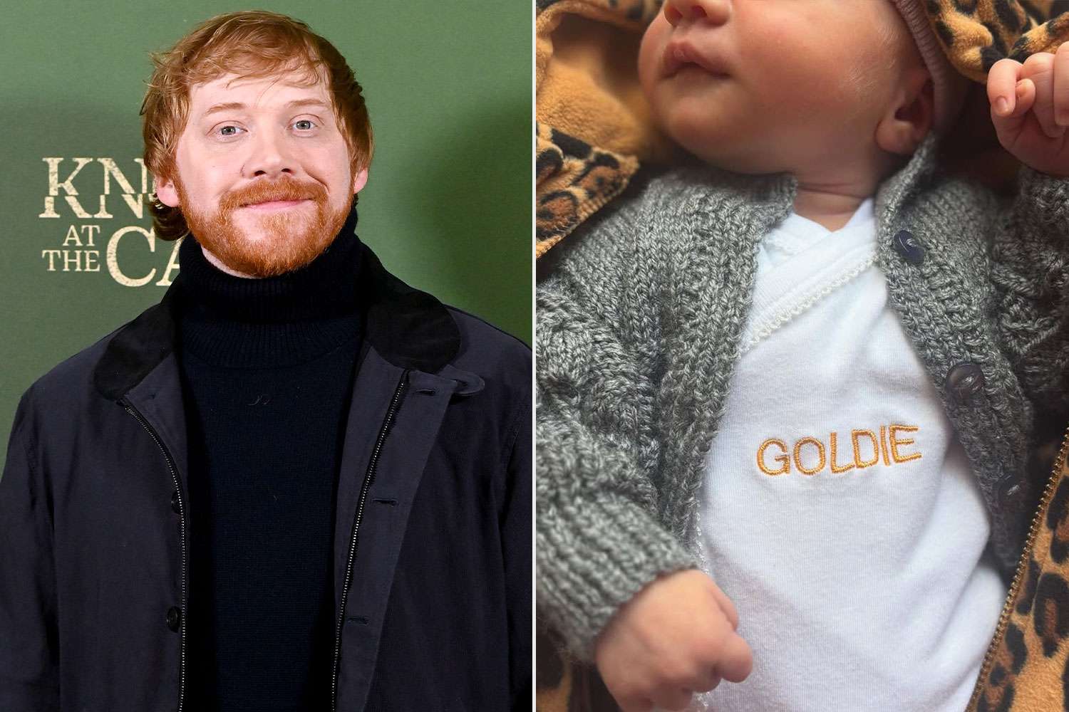 Diam-Diam! Aktor Ron di Harry Potter Umumkan Kelahiran Anak Kedua 