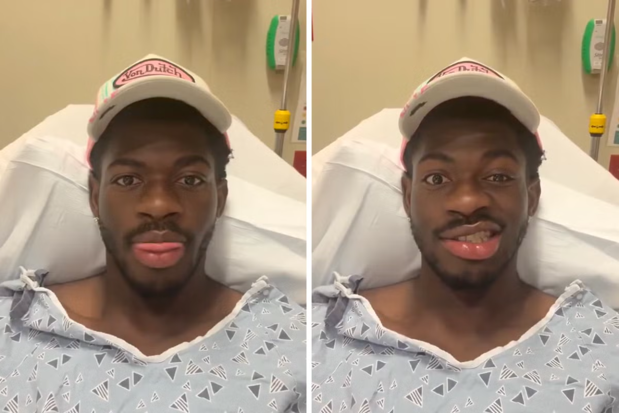 Rapper Lil Nas X Alami Kondisi Wajah Serupa Penyakit yang Sempat Menyerang Justin Bieber