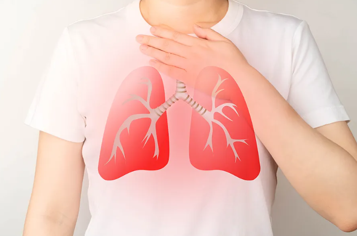 Waspada! Ini 9 Tanda Paru-Paru Basah yang Sering Disangka Flu Biasa