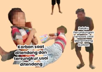 Korban Perundungan di Simalungun, Baru Menjalani Operasi dan Anak Yatim