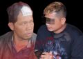 Terkena Tembakan Karena Lasak Saat Cakap, Korban ke Pelaku : Tega Kali Lae