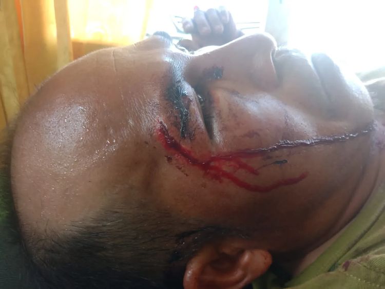 Petani Kecamatan Malin Deman, Kabupaten Mukomuko, Provinsi Bengkulu, yang mengalami kekerasan