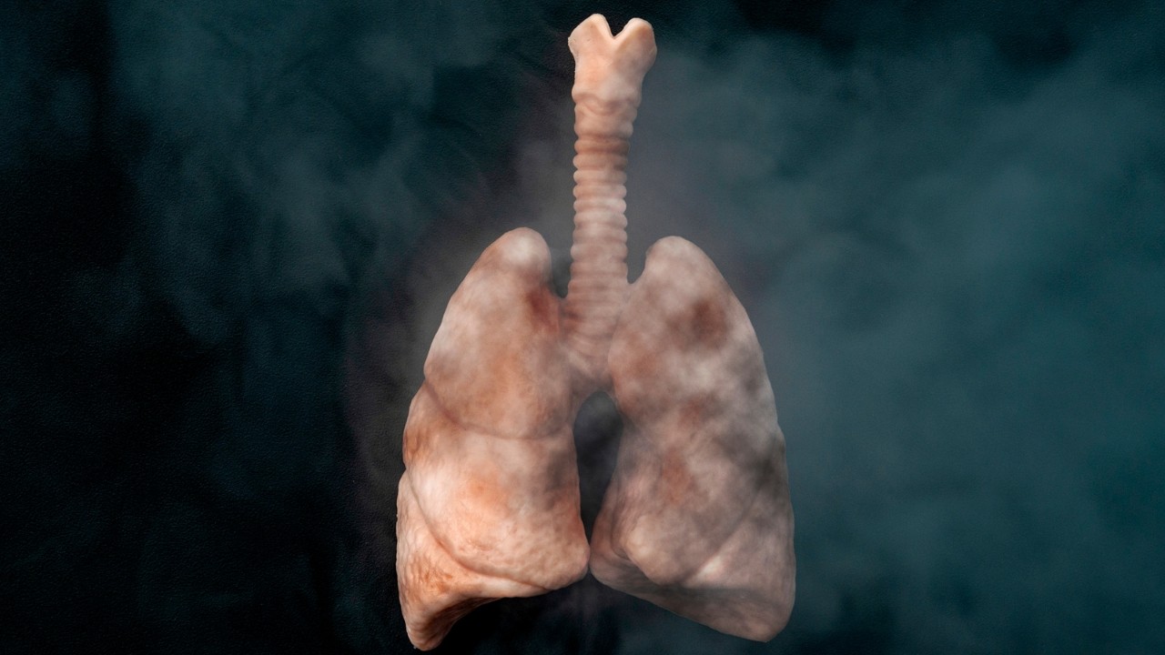 Ragam Alasan Orang Merokok Padahal Berbahaya Bagi Paru-paru