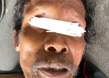 Sosok mayat pria tua tanpa identitas pengenal yang ditemukan tewas dan di evakuasi ke RS Bhayangkara Medan, Jumat (25/11).