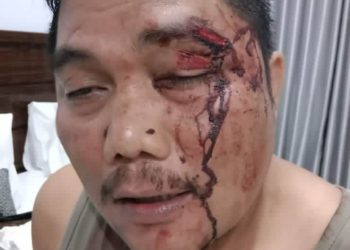 HM juga diduga korban serangan rombongan EES, sehingga kepala mengalami luka serius, Sabtu (10/6). 