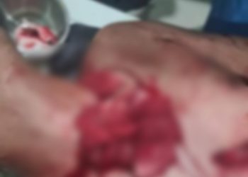 Korban EES saat terbaring mendapat rawatan setelah ditusuk dengan pecahan botol, Sabtu malam (10/6).