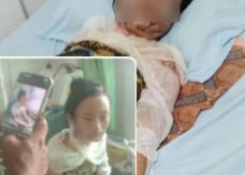 Gawat, Bapak Kandung Diduga Bakar Anak Kandung Pakai Bensin di Desa Prabumenang Lubai Ulu Muara Enim